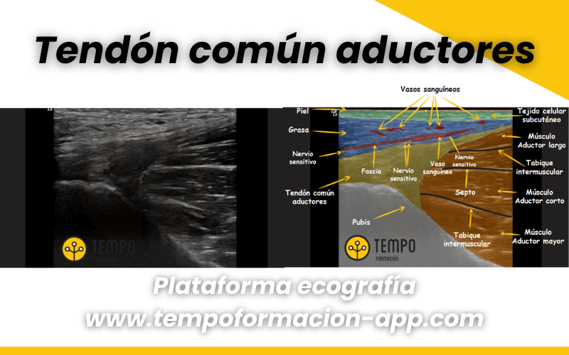 2. Anatomia y ecografia cadera tempo formacion.png